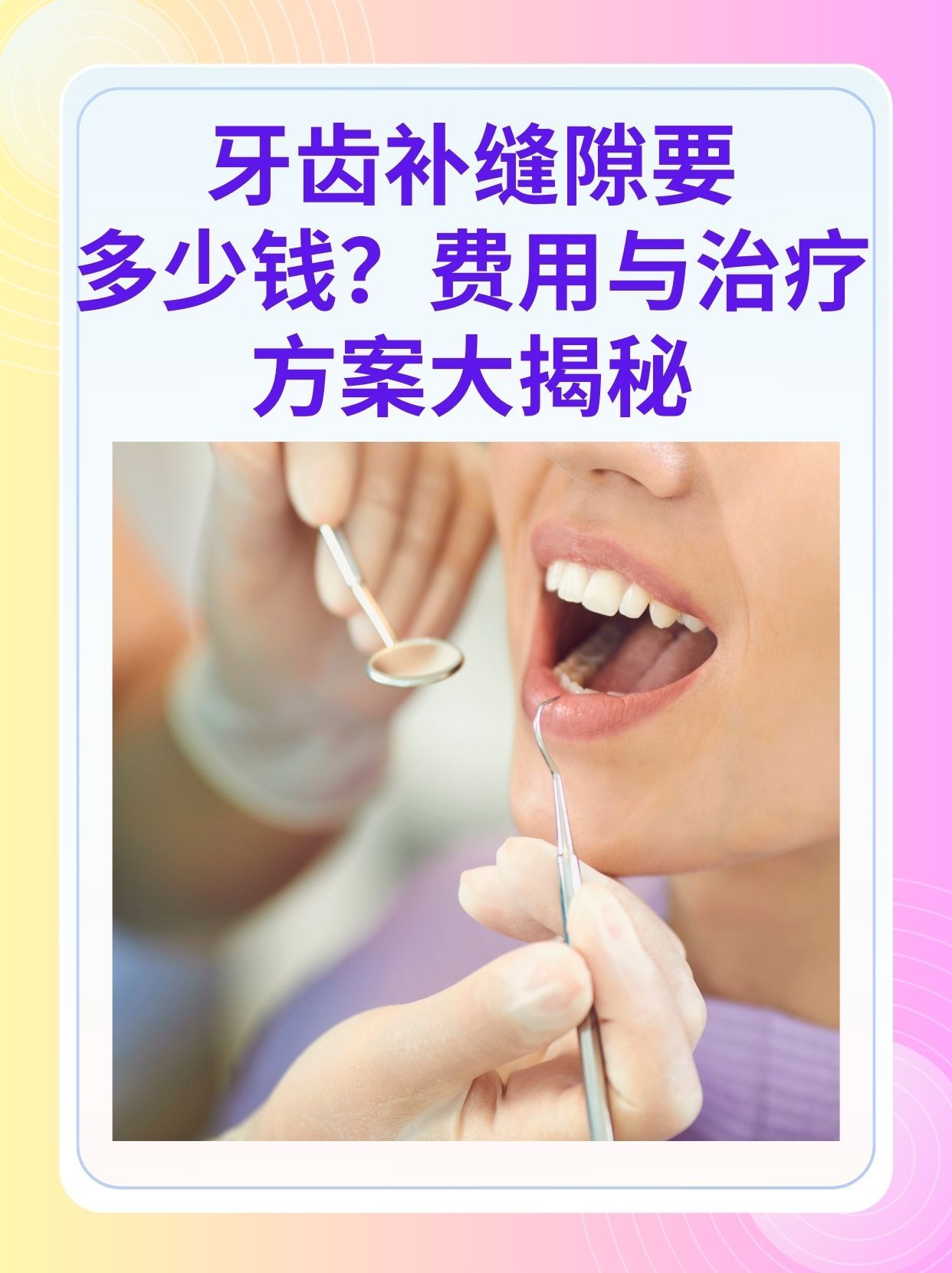 汕尾补牙医保可以报销吗(补牙医保可以报销吗 哪些可以报销呢)